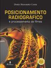 Posicionamento Radiográfico e posicionamento de filmes