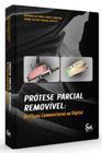 Protese Parcial Removivel: do Fluxo Convencional ao Digital - SANTOS PUBLICAÇÕES LTDA.