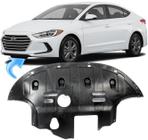 Protetor Carter New Elantra 2.0 16V Flex De 2017 À 2019 - HD