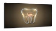 Quadros Decorativos Dente Consultório Dentista em Tecido Canvas 130x60