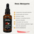 Rosa Mosqueta Óleo Vegetal Puro e Natural Para Rosto Corpo Trata Manchas e Estrias Amaozon 50ml