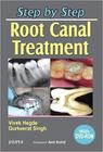 Step by step root canal treatment with dvd-rom - JAYPEE