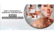 Suavicid creme de clareamento de Manchas e melasma