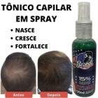 Tônico Capilar 120 ml Em Spray Anti Caspa, Queda E Seborreia