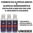 Tratamento Anti Alopecia Areata 3 Tônicos Fortalece Os Fios!