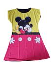 Vestido Mickey Ou Minnie Infantil Adulto