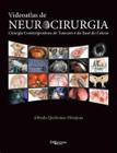 Videoatlas de neurocirurgia cirurgia contemporanea de tumores da base crani - DI LIVROS EDITORA LTDA