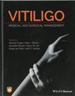 Vitiligo: medical and surgical management