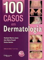 100 Casos em Dermatologia - Di Livros