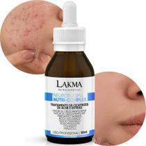 2X Lakma Neuroplasma Nutri Complex 50Ml Cicatriz Acne Estria