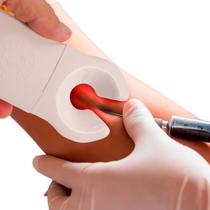 2X Venoscopio Localizador Acha Veia Fleboscopio Profissional