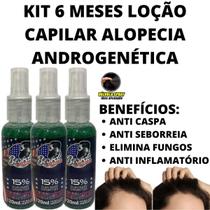 3 Loções Em Spray Para Tratamento De Alopecia Androgenética!