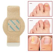 32 tarjas antifungicas para eliminar fungos e mau odor das unhas.