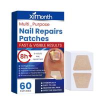 60 Adesivos Para Fungos Nas Unhas, Adesivos Adesivos Para Correção De Unhas Encravadas E Danificadas - NONE