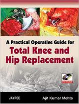 A practical operative guide for total knee and hip replacement