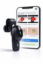 Acessório Dermascope para Smartphone 4x com Aplicativo Acessório Dermascope para Smartphone 4x com Aplicativo