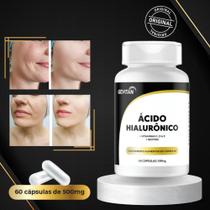 Ácido Hialurônico + Biotina Reduz Envelhecimento e Marcas de Expressão Ácido Hialurônico + Biotina Reduz Envelhecimento e Marcas de Expressão