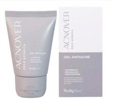 Acnover gel Antiacne - Ruby Rose