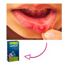 AFTLIV tratamento de aftas bucais 25ml rosa rubra