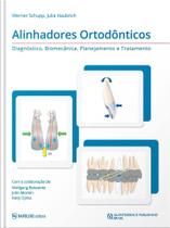 Alinhadores Ortodônticos: Diagnóstico, Biomecânica, Planejamento e Tratamento - Editora Napoleao Ltda.me