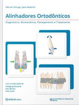 Alinhadores Ortodônticos Diagnóstico, Biomecânica, Planejamento e Tratamento - Editora Napoleão