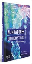 Alinhadores ortodonticos: tecnicas e evidencias - ED NAPOLEAO