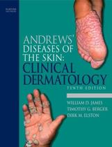 Andrews disease of the skin clinical dermatology