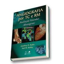 Angiografia por tc e rm - avaliacao vascular abrangente