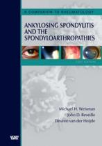 Ankylosing spondylitis and spondyloarthropathies