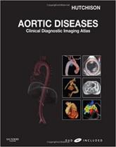 Aortic diseases: clinical diagnostic imaging atlas (dvd included)