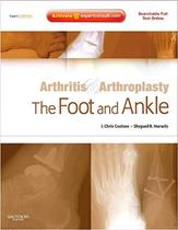 Arthritis and arthroplasty: the foot and ankle - W.B. SAUNDERS Arthritis and arthroplasty: the foot and ankle - W.B. SAUNDERS