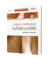 Arthritis and Arthroplasty: The Foot and Ankle - W.b. Saunders