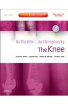Arthritis and arthroplasty: the knee - dvd inside - W.B. SAUNDERS