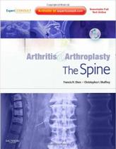 Arthritis and arthroplasty: the spine - ELSEVIER (IMPORTADOS)