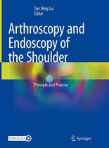 Arthroscopy and endoscopy of the shoulder - Springer Nature (import) Arthroscopy and endoscopy of the shoulder - Springer Nature (import)