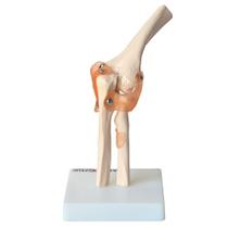 Articulação Do Cotovelo Com Ligamentos Articulação Do Cotovelo Com Ligamentos