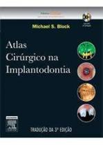 Atlas Cirúrgico na Implantodontia