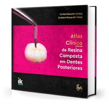 Atlas clínico de resina composta em dentes posteriores - Santos Publicações