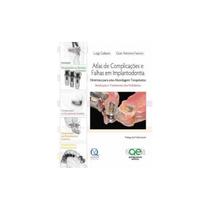 Atlas De Complicações E Falhas Em Implantodontia - Diretrizes Para Uma Abordagem Terapêutica