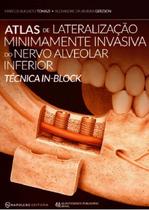 Atlas De Lateralização Minimamente Invasiva Do Nervo Alveolar Inferior. Técnica In-Block - Napoleão Atlas De Lateralização Minimamente Invasiva Do Nervo Alveolar Inferior. Técnica In-Block - Napoleão