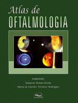 Atlas De Oftalmologia - Med Book Editora Cientifica Ltda