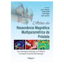 Atlas de ressonancia magnetica multiparametrica da prostata - DI LIVROS