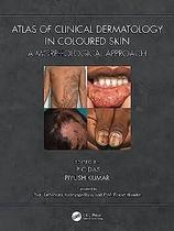Atlas of clinical dermatology in coloured skin - Taylor And Francis Group Llc