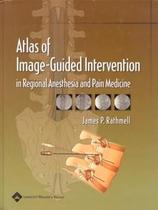 Atlas of image-guided intervention in regional anesthesia and pain medicine - LWW - LIPPINCOTT WILIANS & WILKINS