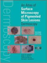Atlas of microscopy pigmented skin lesions dermoscopy - Mcgraw Hill Education