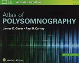 Atlas of polysomnography - LIPPINCOTT/WOLTERS KLUWER HEALTH