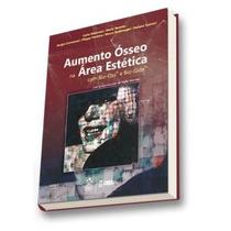 Aumento osseo na area estetica - SANTOS
