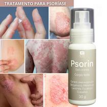 Auxílio no Cuidado da Pele com Psoríase - Psorin 30g