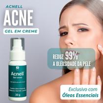 Auxilio para Acne Acnell 30gr Auxilio para Acne Acnell 30gr