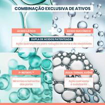 Avène Cleanance Intense Gel de Limpeza Facial Profunda